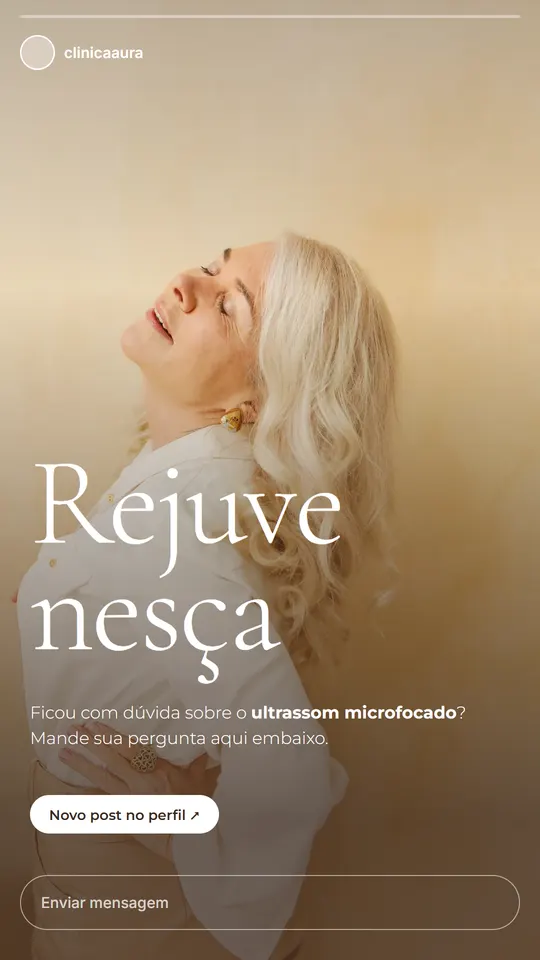 Story do modelo Protocolo do mês